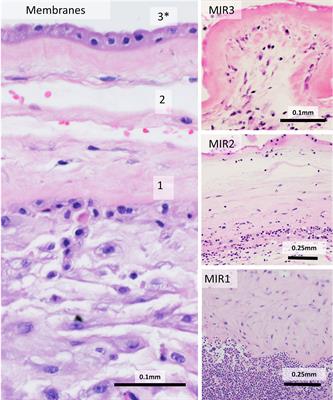 Maternal-Fetal Inflammation in the Placenta and the Developmental Origins of Health and Disease